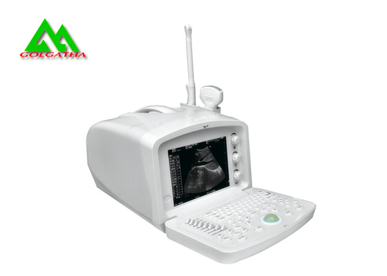 China Digital Medical Ultrasound Equipment Human Ultrasound Scanner With LCD Display supplier