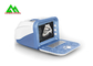 Digital Medical Ultrasound Equipment Human Ultrasound Scanner With LCD Display supplier