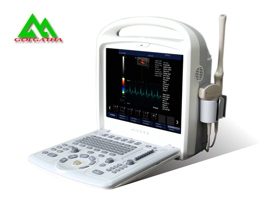 China Hospital Medical Ultrasound Equipment Portable Color Doppler Laptop Design supplier