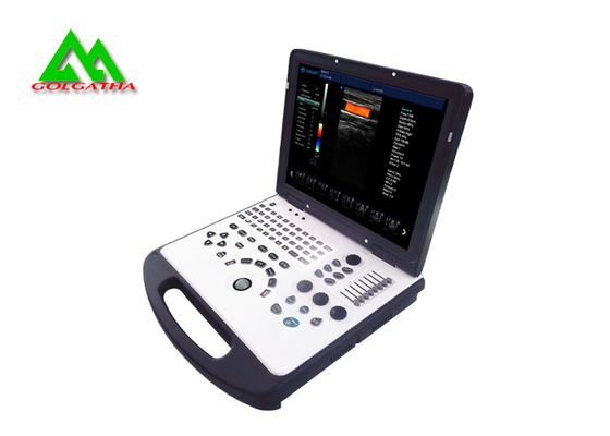 China High Accuracy Laptop Ultrasound Scan Machine With Lithium Battery For Human Use supplier