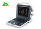 Hospital Medical Ultrasound Equipment Portable Color Doppler Laptop Design supplier