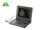 High Accuracy Laptop Ultrasound Scan Machine With Lithium Battery For Human Use supplier